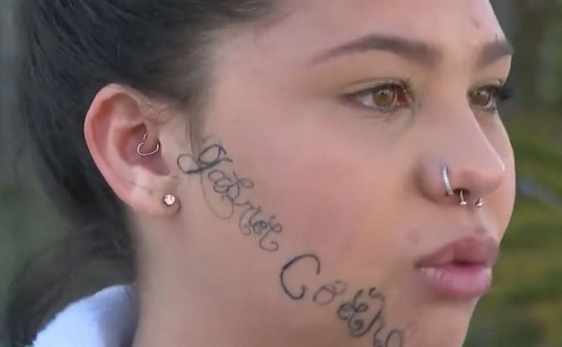 Jovem passará por procedimento para retirar tatuagens feitas pelo ex
